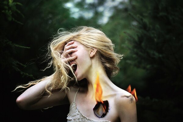 Niña grita herida por fuego